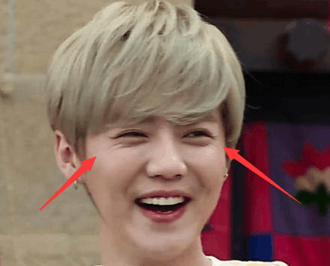 鹿晗这些年怎么了? 眼角的那些皱纹, 可把粉丝