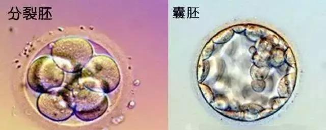 鲜胚?冻胚?囊胚?胚胎移植这些词都是什么意思?