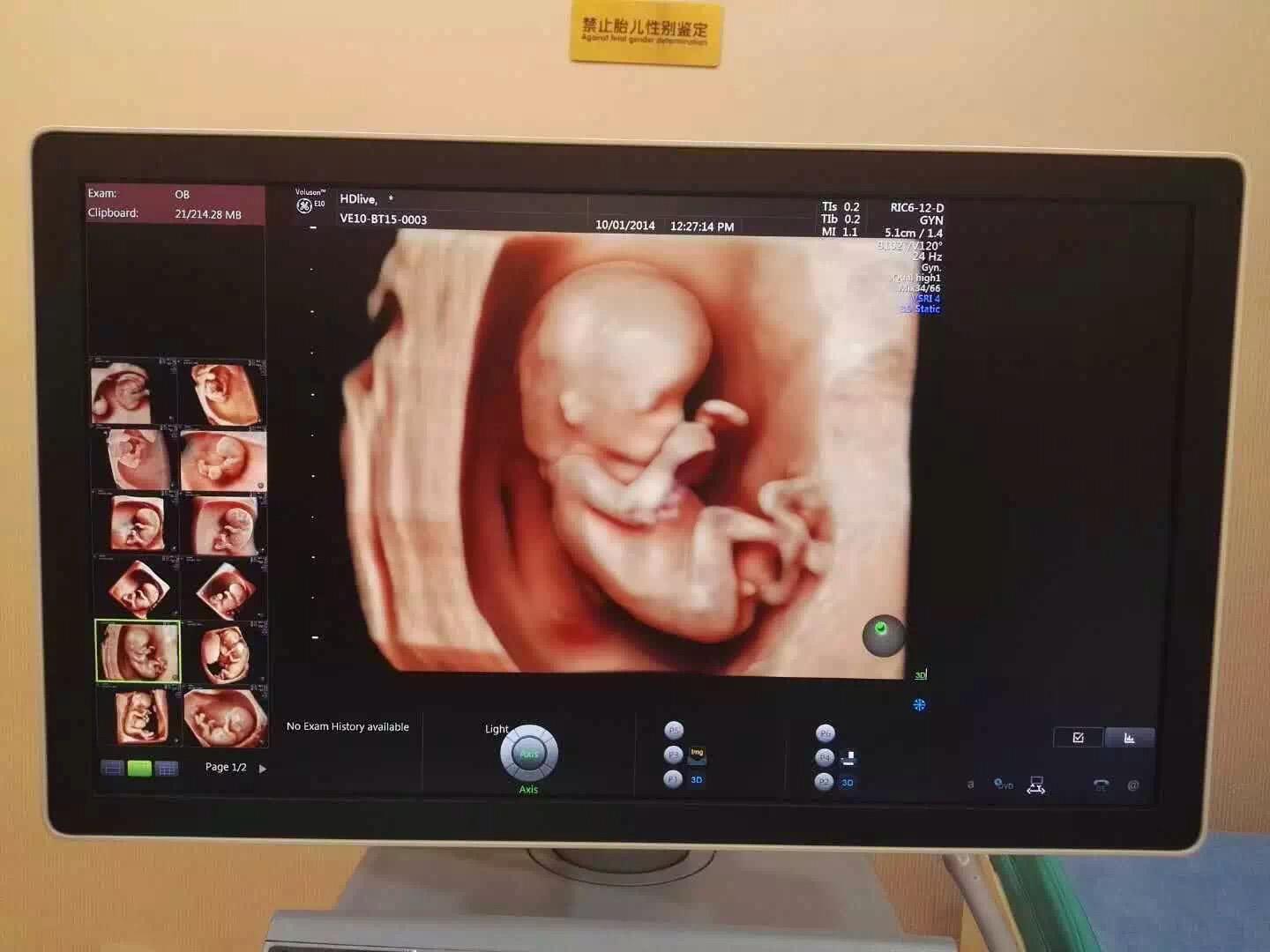 90后孕妇做四维检查,医生突然的一番话,全家人当场脸