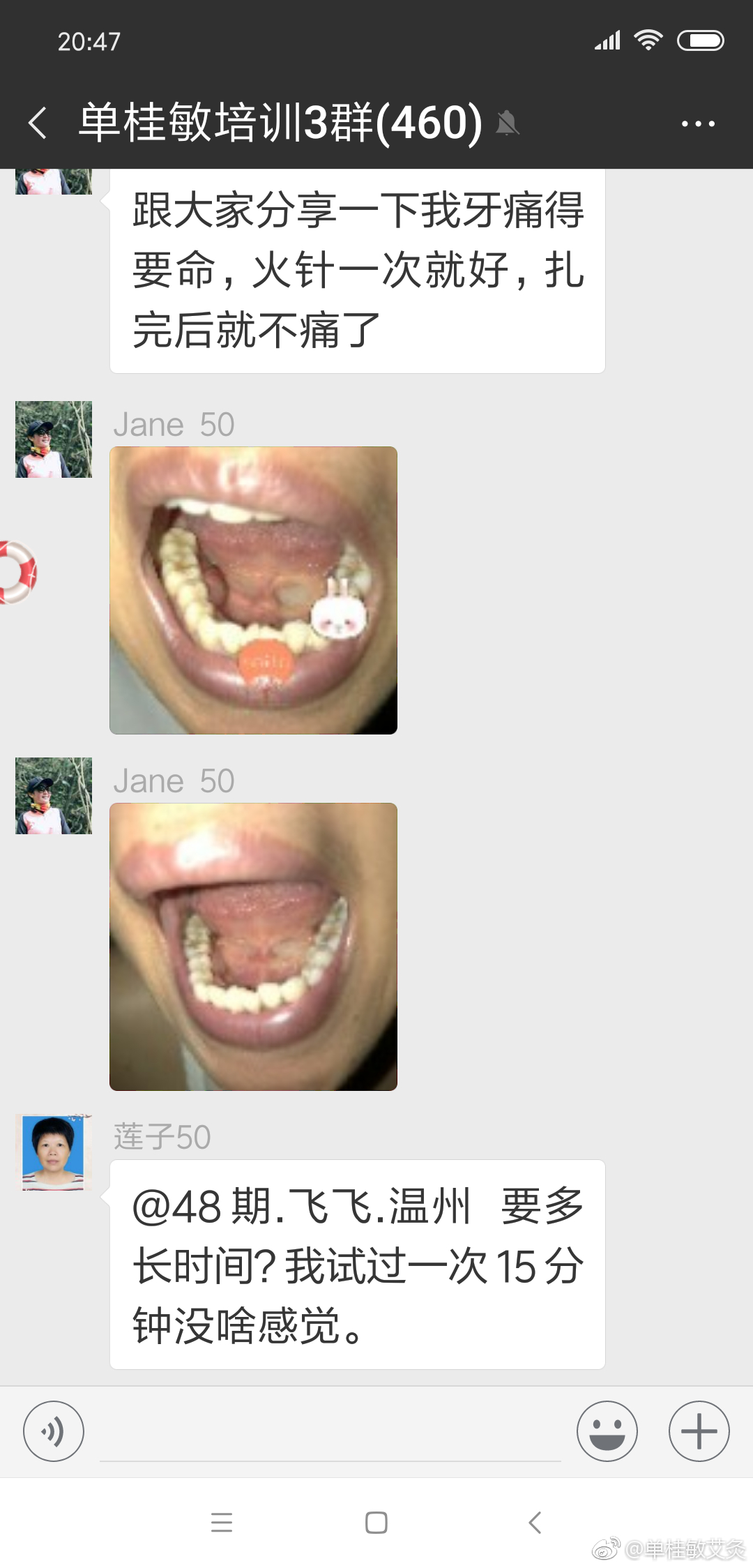 火针治疗牙痛,牙龈萎缩