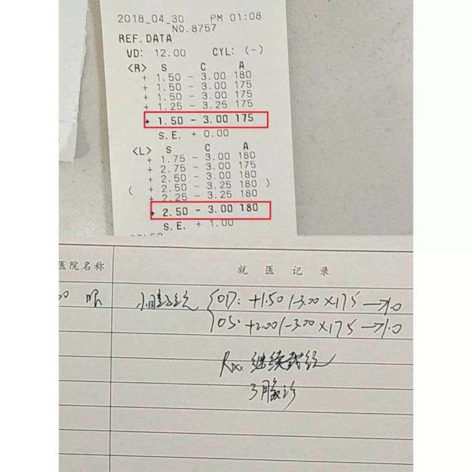 8岁散光导致弱视,医学表示散光没办法是这样吗