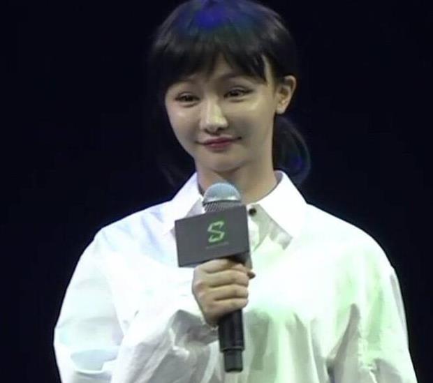 LOL第一女主播Miss整容了? 线下活动脸部浮肿