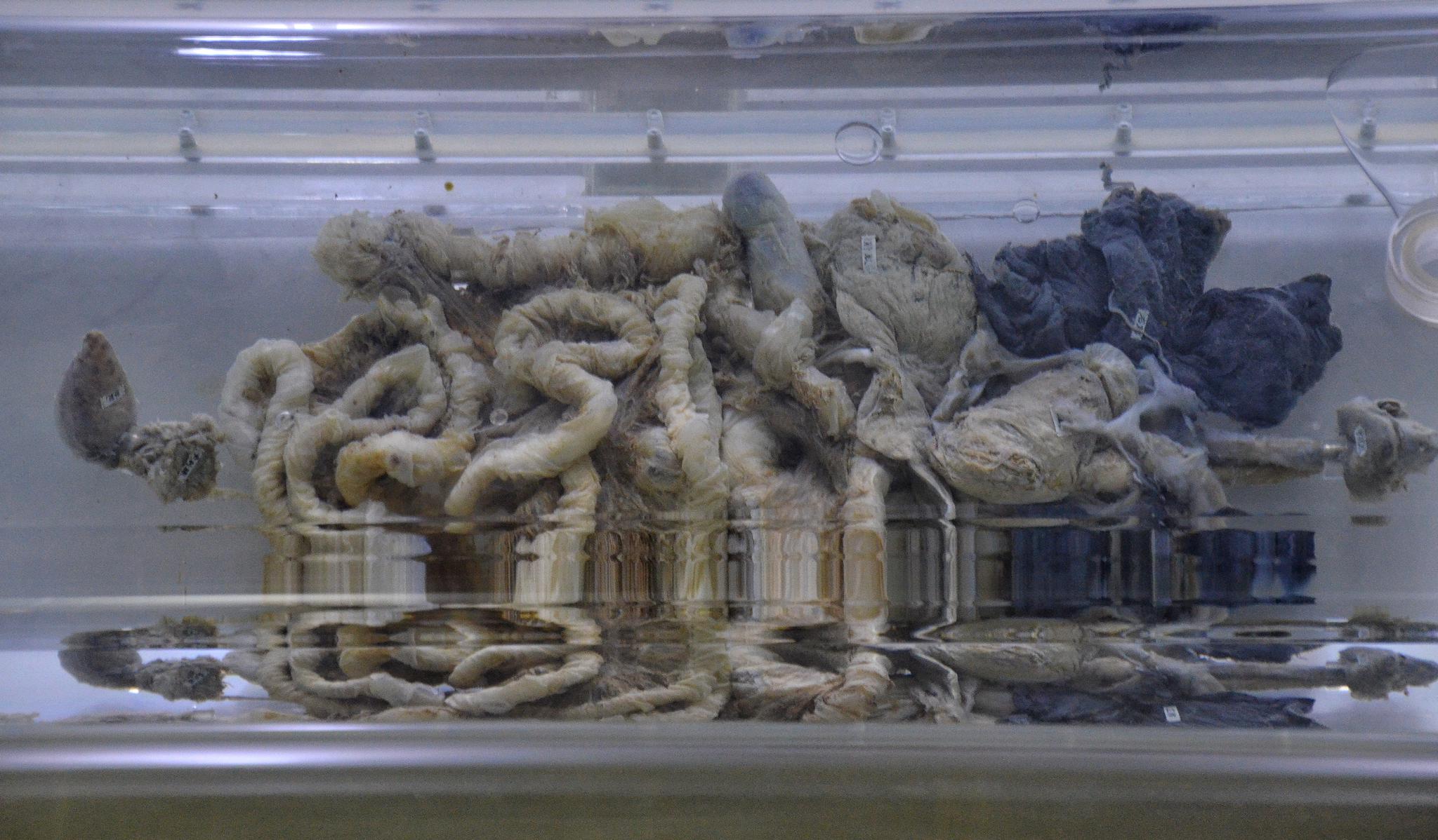 欧洲沼泽里挖掘出多具千年古尸，不腐不化，这能用科学...