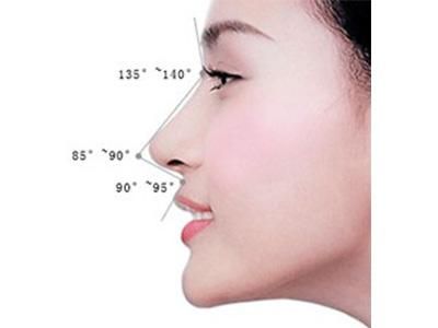 隆鼻能改善凸嘴和鼻唇沟吗?