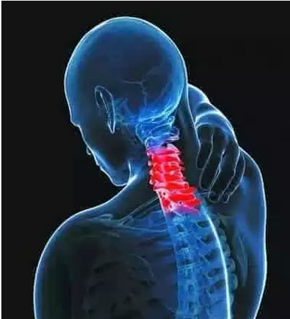 专家:治疗颈椎病的好方法,颈椎病最好治疗办法