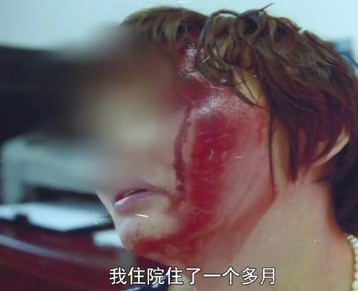 女子拒绝给继子买房被丈夫殴打,丈夫:离婚四次