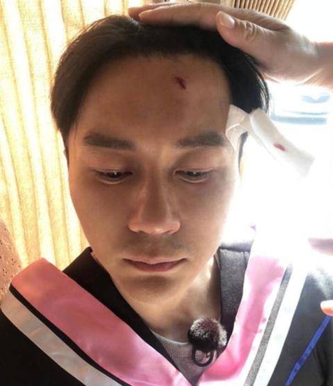 祛痘印药膏排行榜_范冰冰晒素颜自拍,求网友推荐祛疤药物,用来涂抹李晨额头伤疤