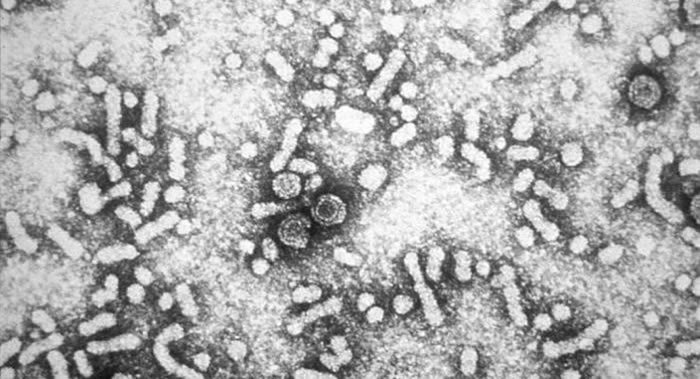 俄罗斯科学家研制出可破坏乙型肝炎病毒基因组