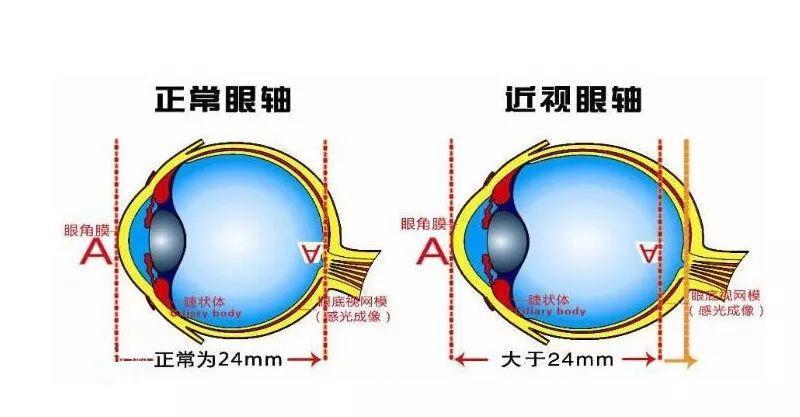 眼镜框选得好,效果堪比整容!你的脸型适合哪一款
