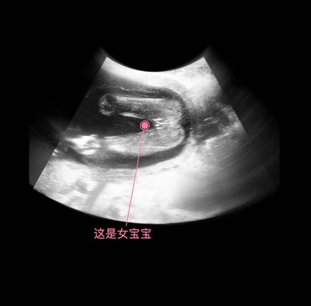17周胎儿在腹部位置图,怀孕第17周胎儿图片 胎儿从卵泡到孕17周,17张图片清晰诠释,男宝女宝看得很清楚