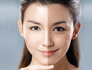 夏天一晒斑就出来了,厨房几毛钱的大蒜,可以祛