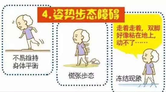 帕金森手术入医保 神经调控未来有多神奇?