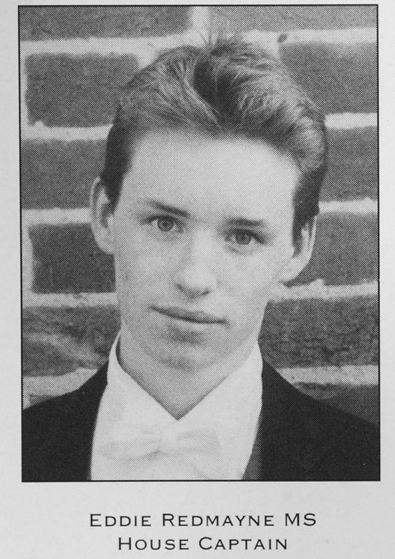 小雀斑埃迪拍戏受伤,小腿至脚掌被固定架固定