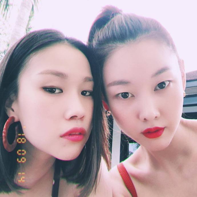 韩国女星跌倒撞肿鼻子被网友怀疑隆鼻，为证清白节目上直接照X光