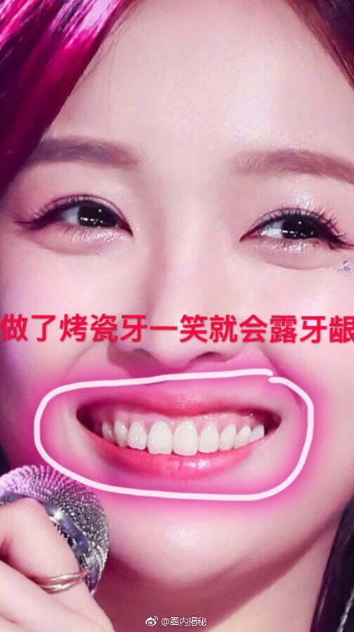 网友投稿创造101选手吴宣仪整容对比实锤,你们