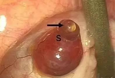 女人排卵过程到底是啥样? 看完这组照片就知道