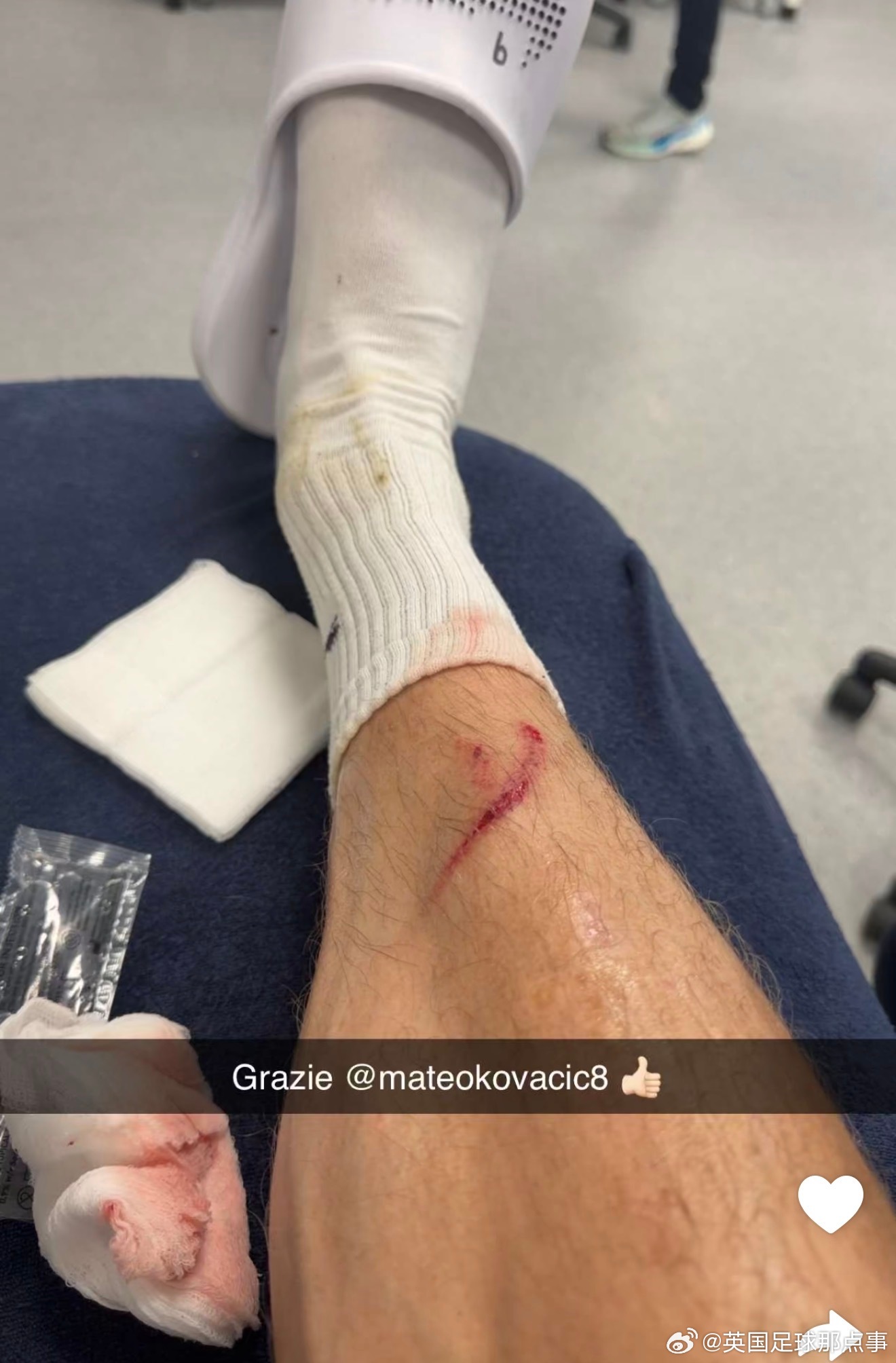 哈兰德晒腿伤照致谢队友科瓦契奇
