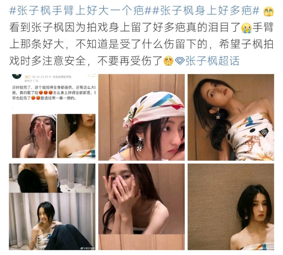 张子枫手臂现明显疤痕引关注