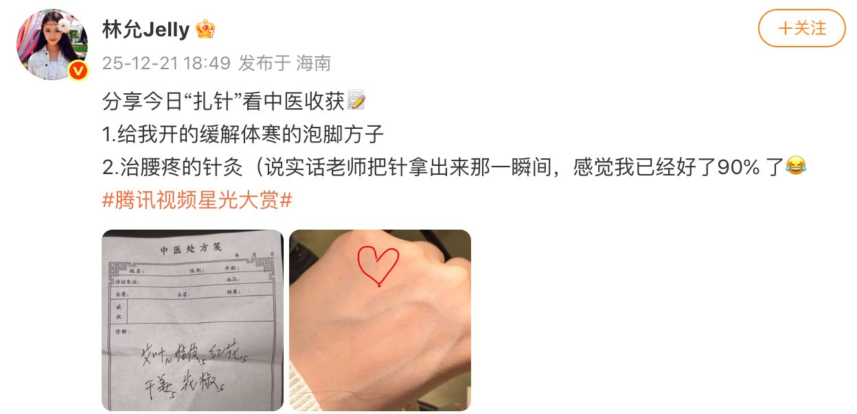 林允分享中医针灸治疗腰疼经历