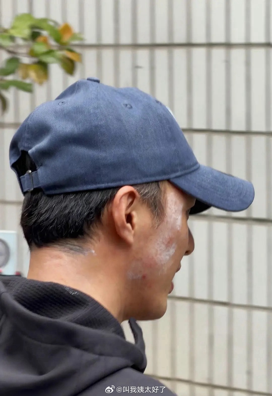 叶祖新拍戏头套粘连致脸部受伤