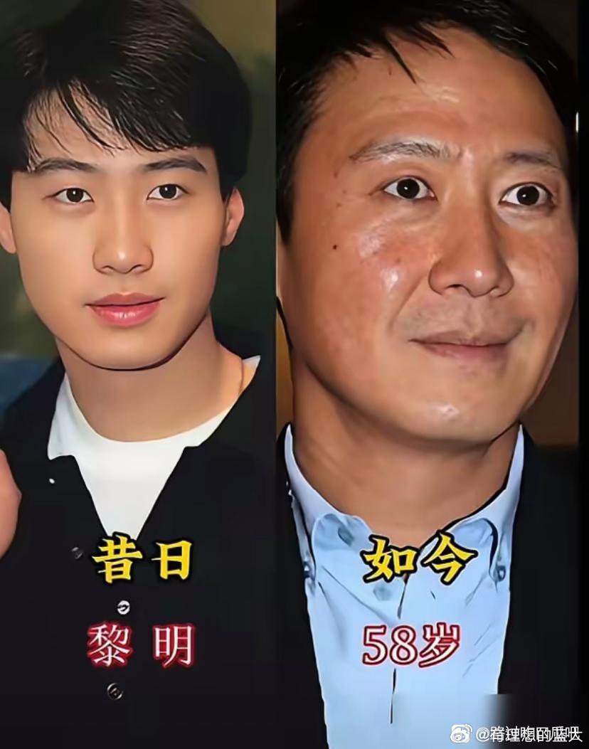 黎明颜值变化引热议，昔日天王今昔对比悬殊
