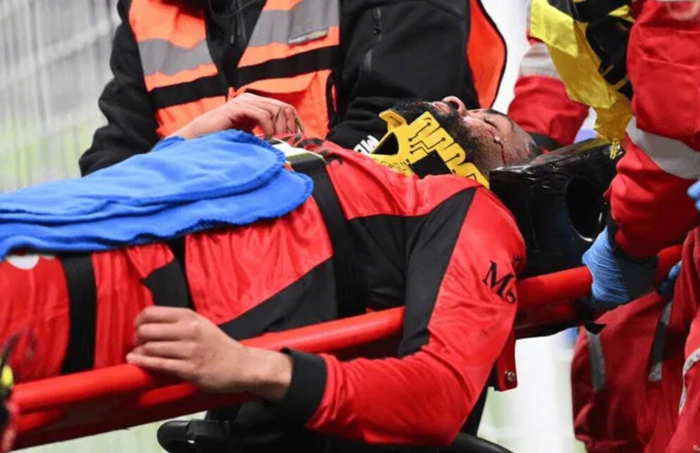 米兰中场奇克牙槽骨骨折将手术，赛季或报销