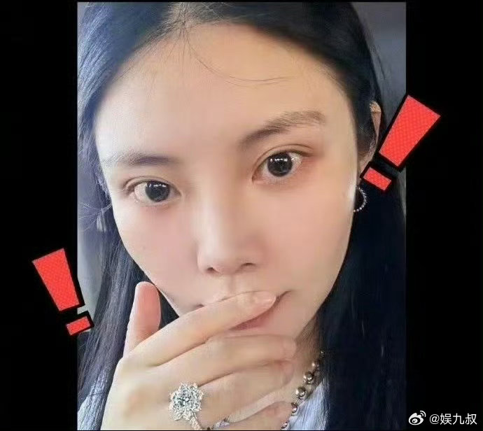 徐冬冬接连丢失婚戒手链