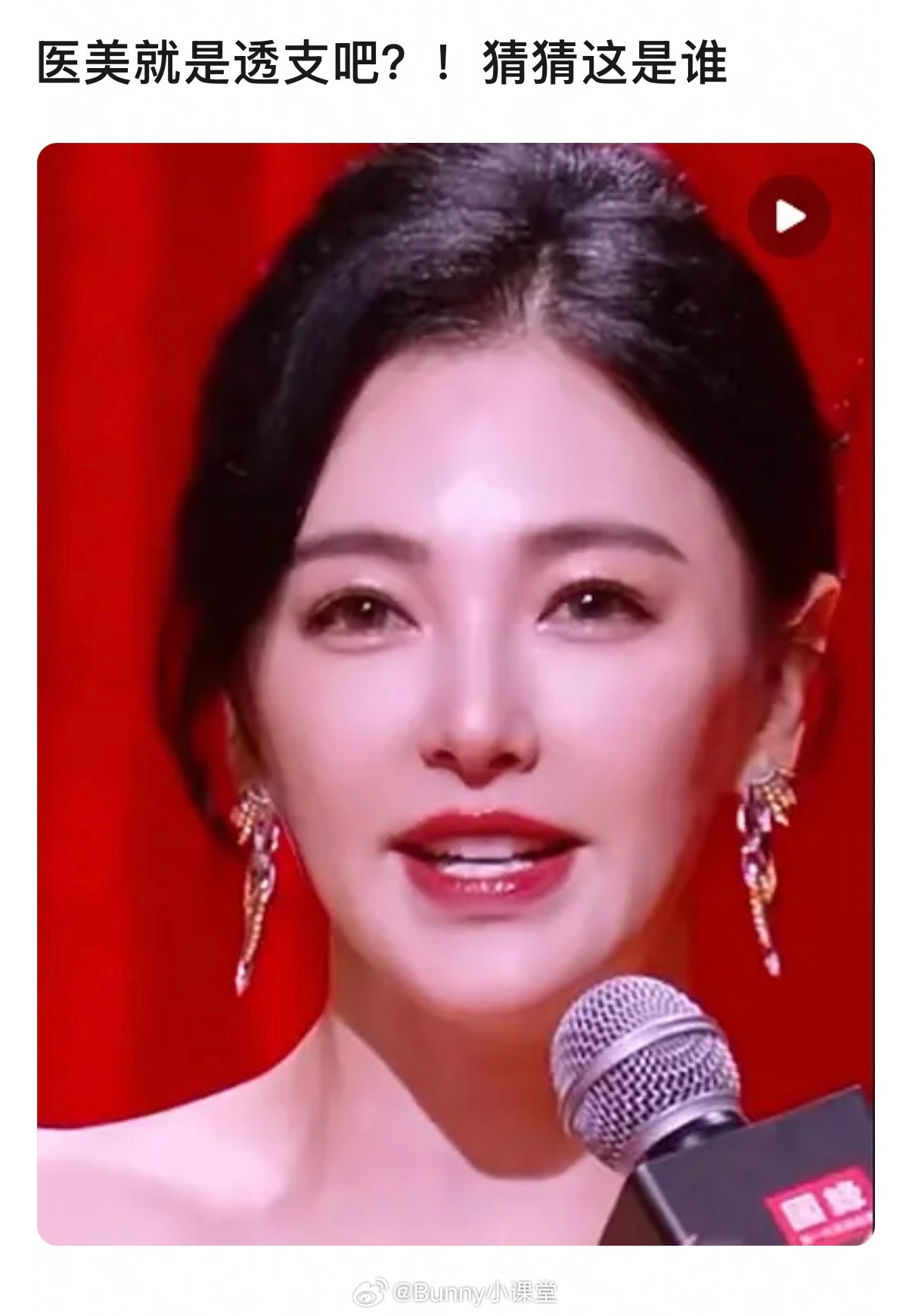 张雨绮容貌变化引热议，网友惊呼认不出