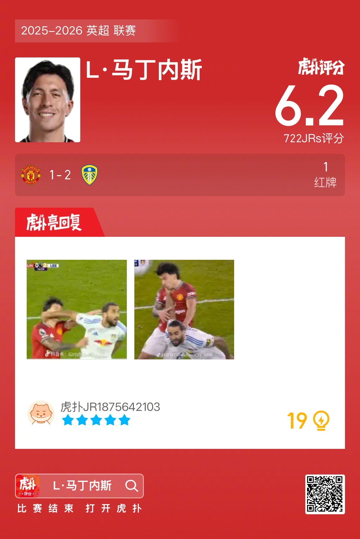 曼联1比2负利兹联，利马染红离场