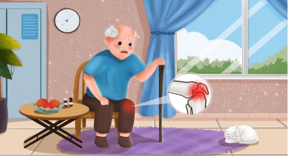 女性50岁后手部现Heberden结节，专家称系骨关节炎典型表现