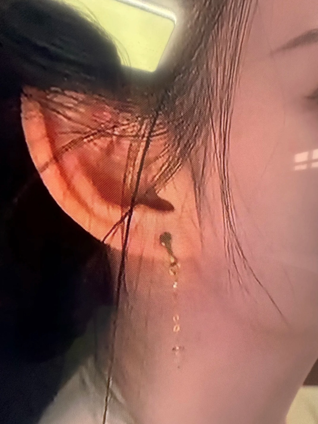 王楚然佩戴耳夹引关注，耳垂泛红显不适