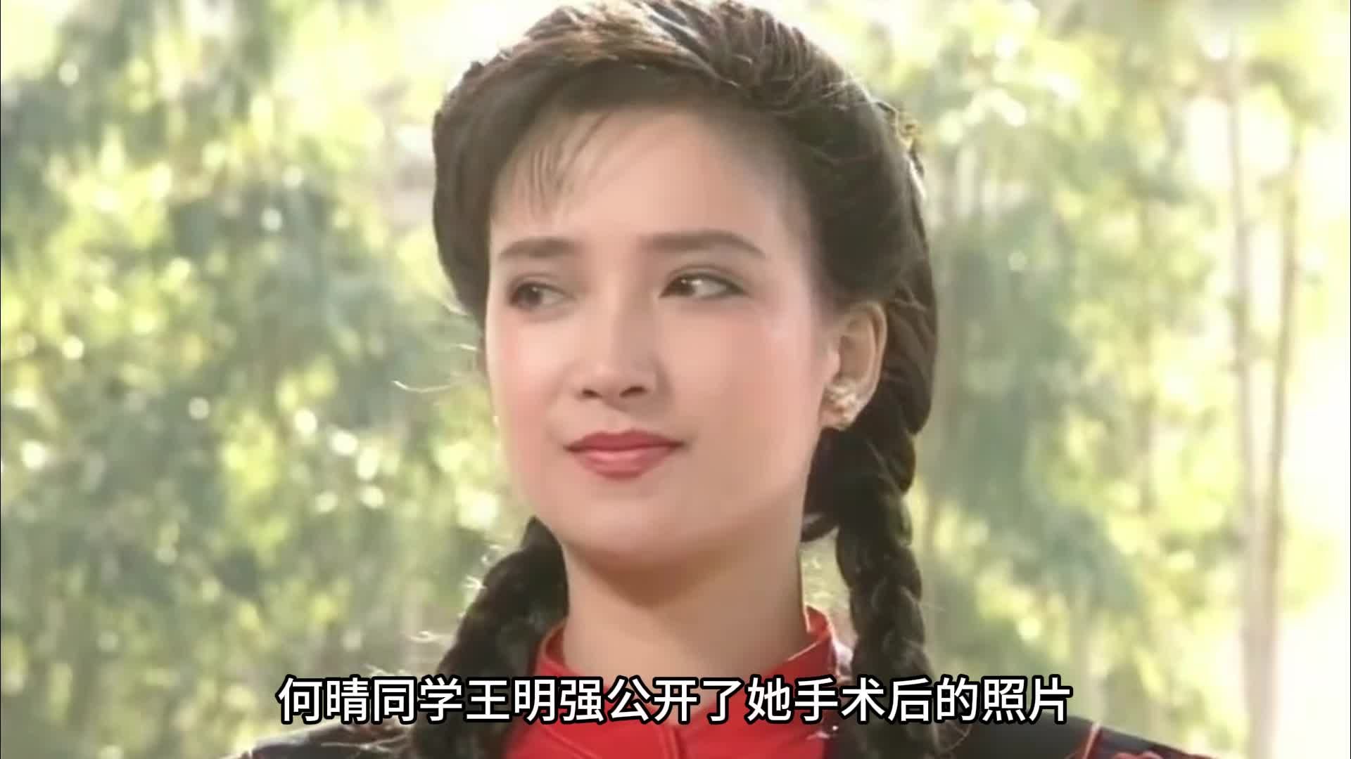 61岁何晴病逝，同学公开手术合照引发质疑，张纪中金晨发文哀悼