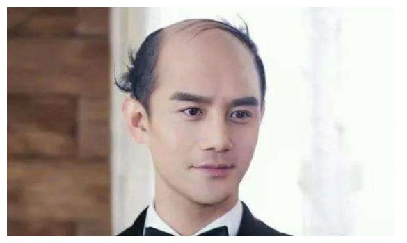 为什么秃顶的人,宁愿周围留一圈头发,也不愿意剃光头?