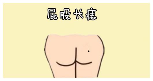 屁股长痣在相学当中,若是一个人的屁股的位置处长有吉痣,则属于"