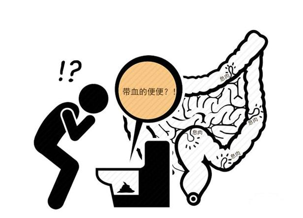 癌细胞|大便|胰腺癌_新浪新闻