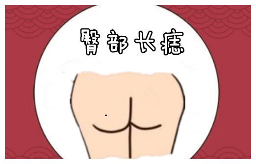有钱人的痣长在哪里你有几颗