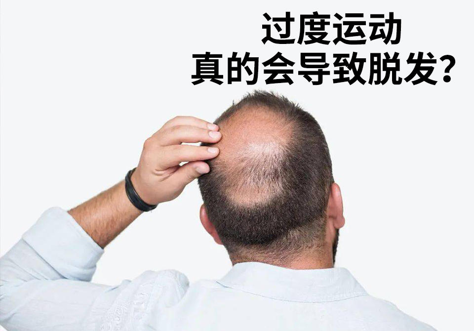 揭秘:健身和脱发有何关联?