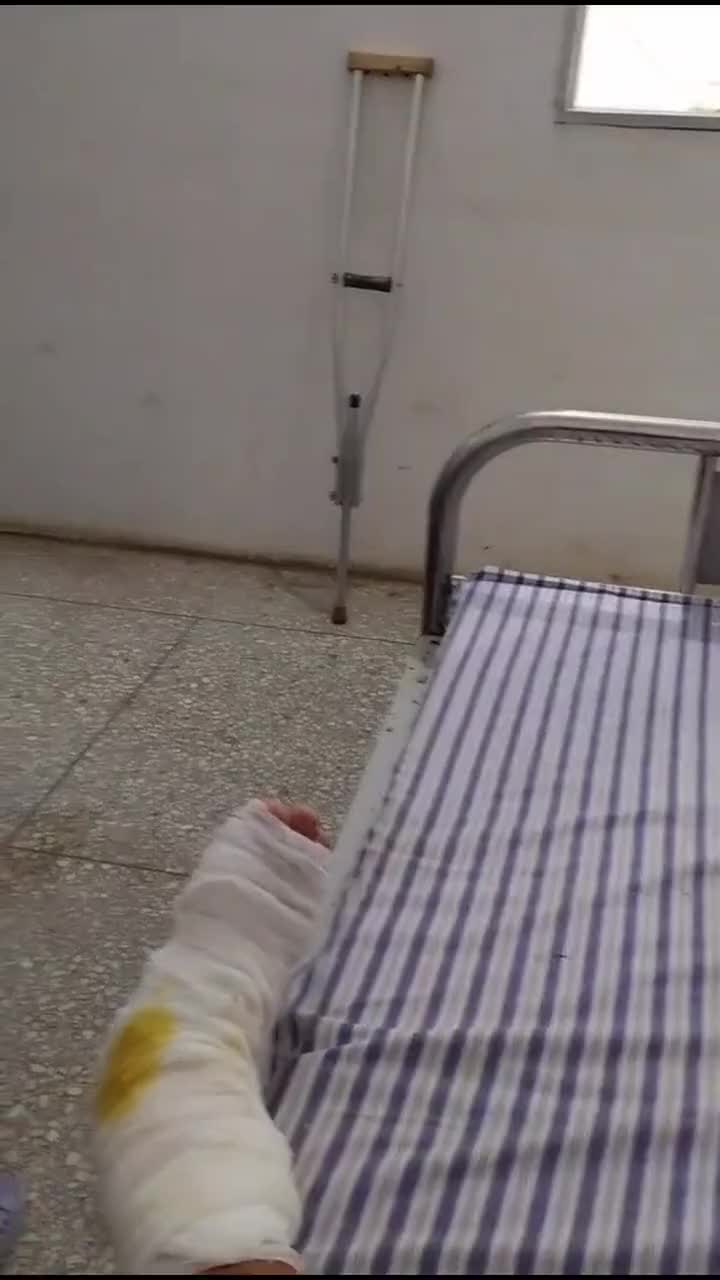 脚受伤了来住院,居然碰见难兄难弟,拖鞋正好一人一只!