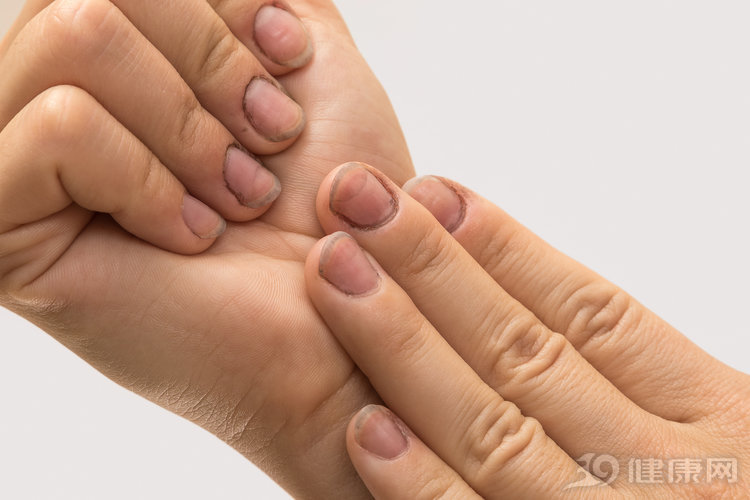 指甲上长了黑色竖纹,是黑色素瘤吗?皮肤科主任教你如何分辨
