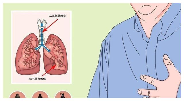 肺结核会引起后背疼吗