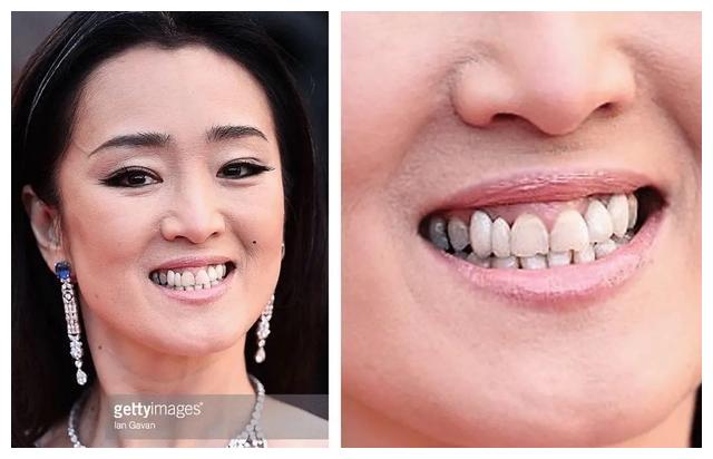 她牙齿问题太大了一点,不过,现在她的牙齿依旧没有很完美,这也算是