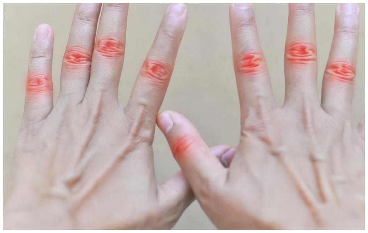 手指关节痛的原因有哪些学会这2个动作缓解不适感