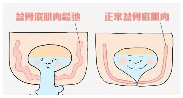 骨盆痛是什么症状 8e52-kcieywa2473478.jpg