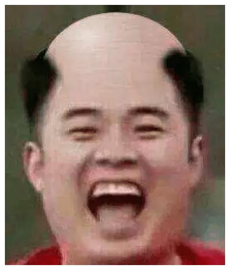 从下图我们可以看到,经过网友们的恶搞,陈赫变成了地中海发型,头顶