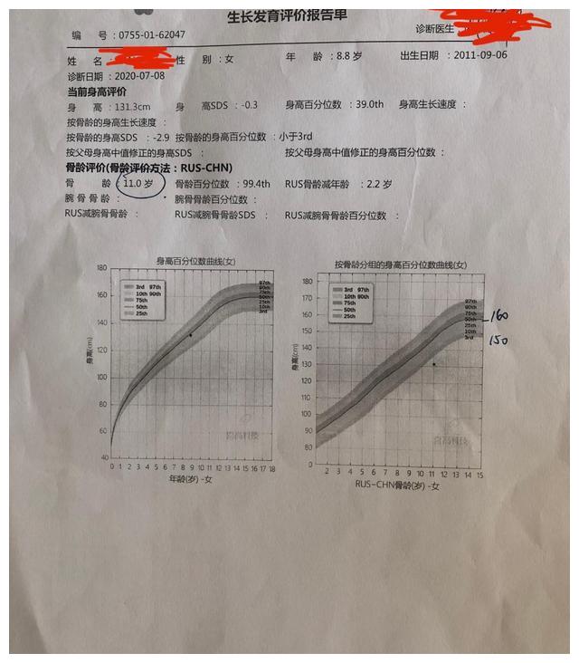 同一骨龄鉴定数据结果误差较大,原因在哪?