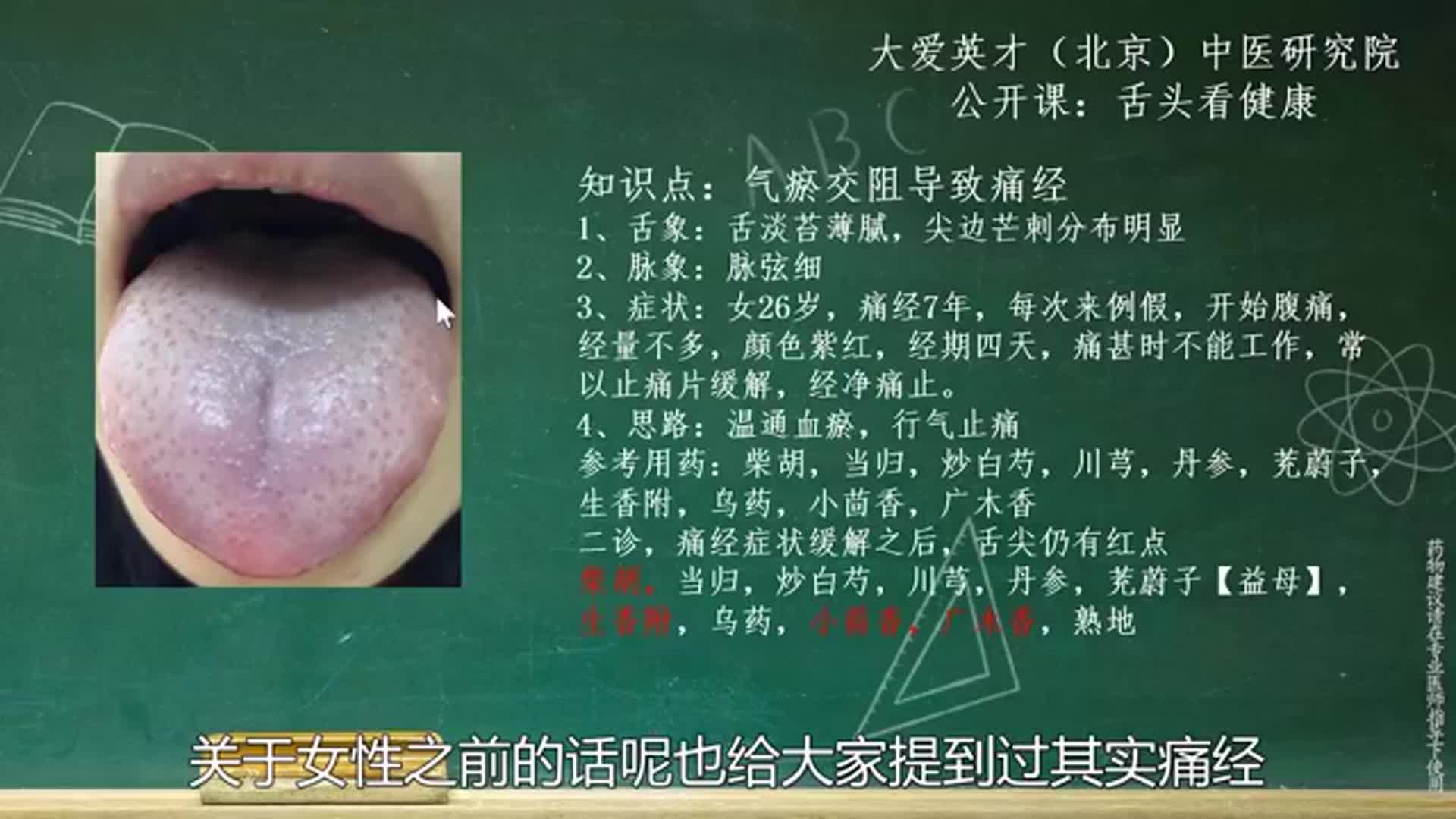 舌象分析:由于气滞血瘀导致慢慢出现痛经建议温通血脉