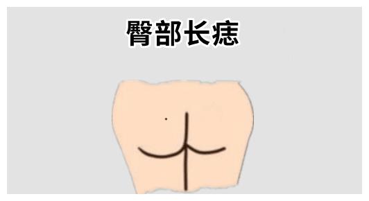 身上5颗巨富痣颗颗显富贵越隐蔽越好老了有钱又有福