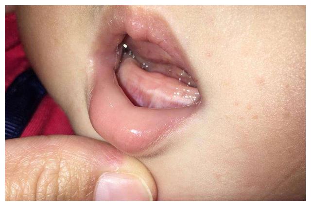 冷水能适当缓解长牙给宝宝带来的不适感,还能擦除残留在嘴边的口水