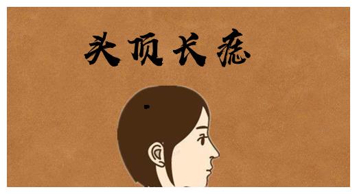 身体6颗"发家"痣,辈辈发财,代代富,一旺3代人