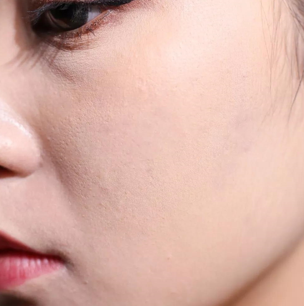 菲玛吉水光针适合什么肤质 菲玛吉水光针功效全解析